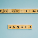 Aspirine et prévention du cancer colorectal : des bénéfices remis en question